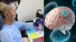 چینی سائنسدانوں کی تیار کردہ دماغی چپ سے معذور شخص حرکت کرنے کے قابل