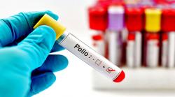 تشویشناک خبر ، پشاورکےماحولیاتی نمونوں میں پولیو وائرس کی تصدیق